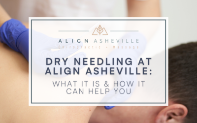 Dry Needling at Align Asheville: What It Is & How It Can Help You
